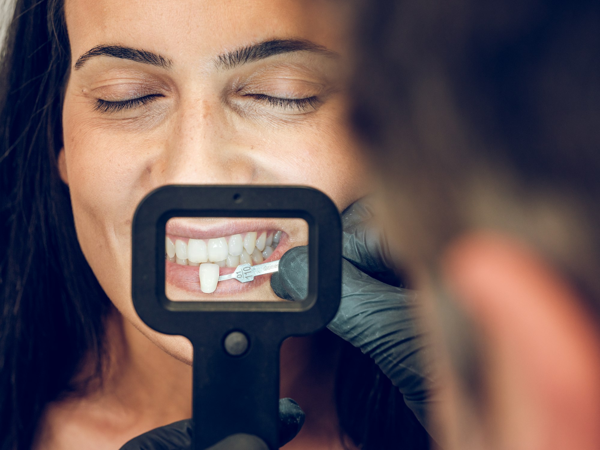 Dentist picking sample of teeth veneer for woman